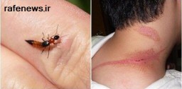 حشره دراکولا به چه کسانی حمله می‌کنند ؟